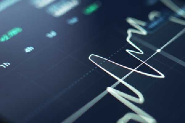 赵兴言：黄金连续上涨破位高点，欧盘关注4575分水岭！